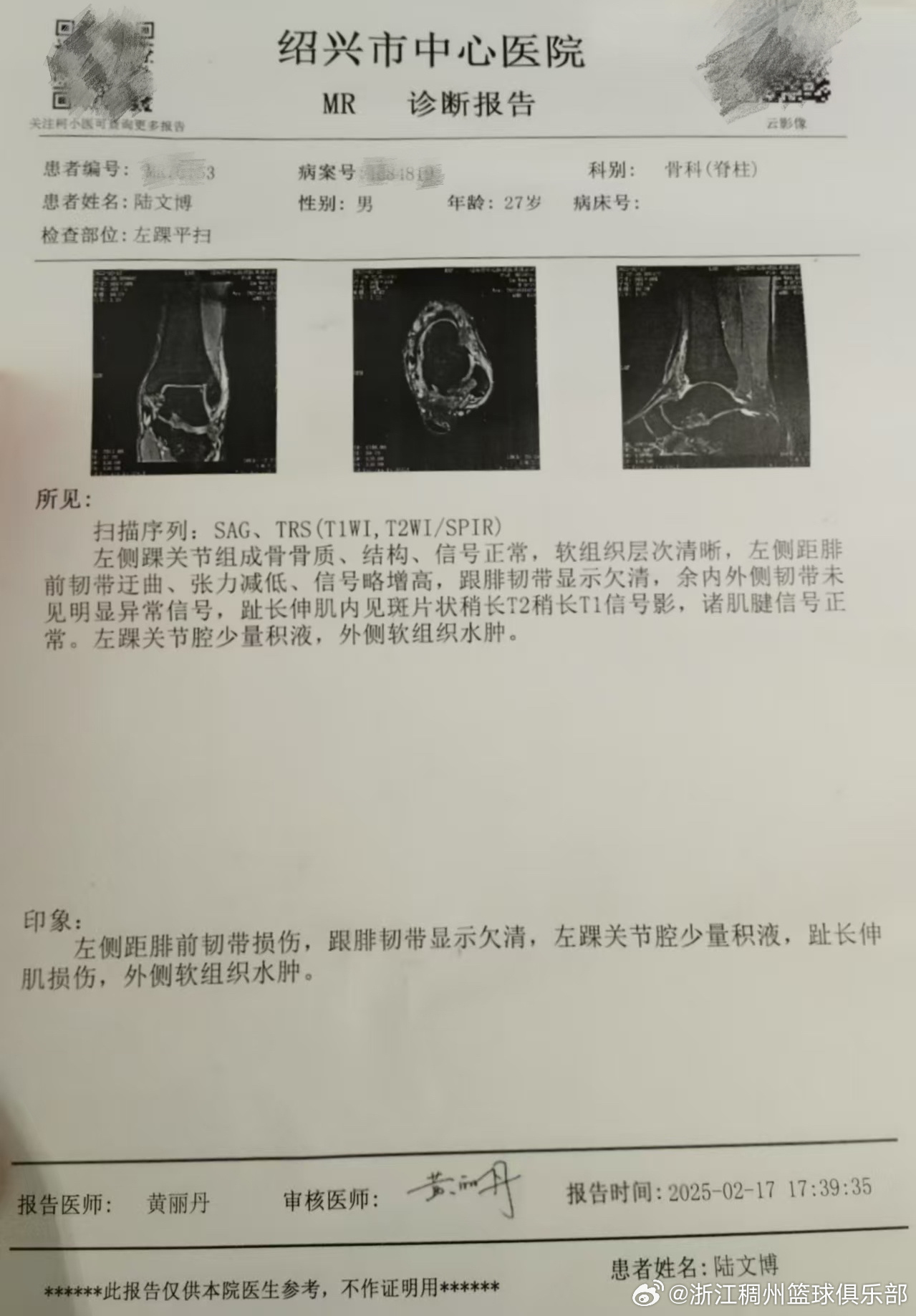 正是这类球